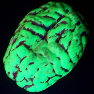 Brain GLOW